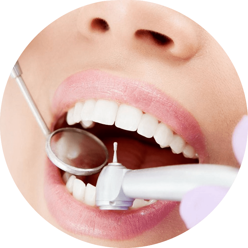 Профессиональная гигиена полости рта. Зубы с кариесом стоматология. Сайт стоматологии. Лечение кариеса ульяновск